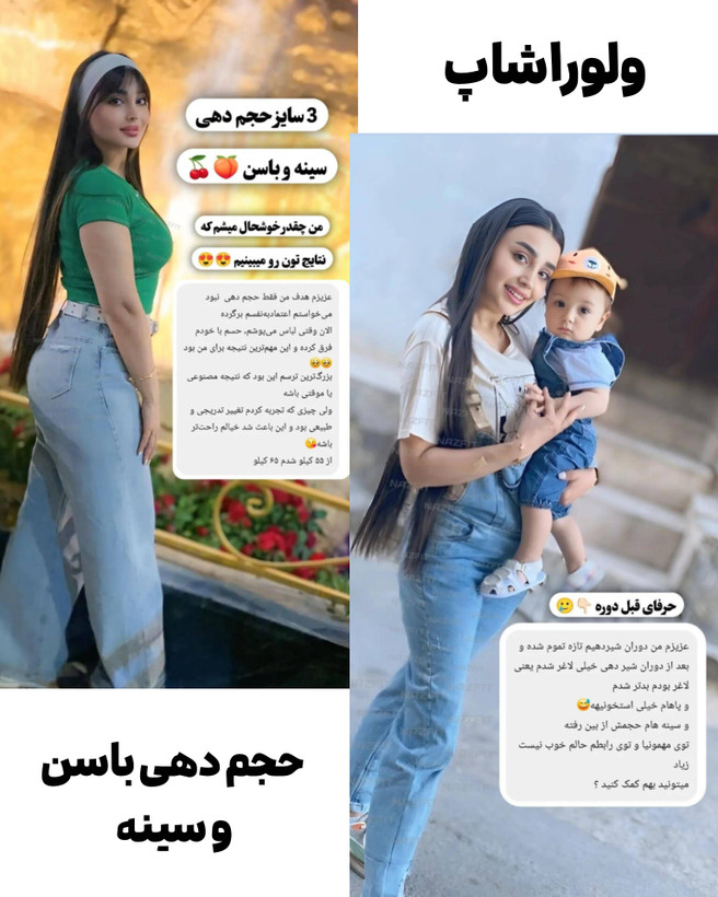 افزایش حجم باسن ۸۰ روزه _۸ تا ۱۲ سایز