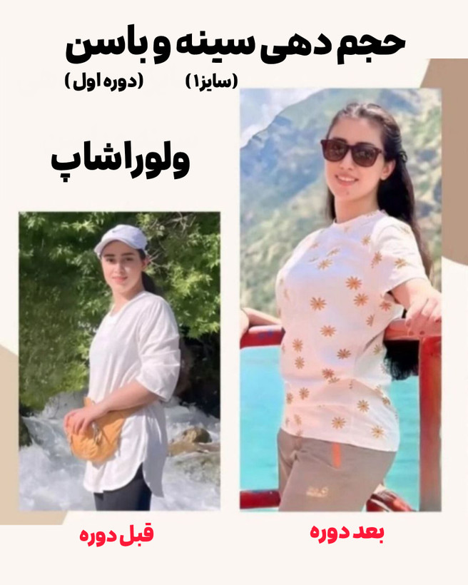 افزایش حجم باسن ۸۰ روزه _۸ تا ۱۲ سایز