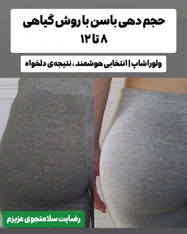 افزایش حجم باسن ۴۰ روزه _۴ تا ۶ سایز