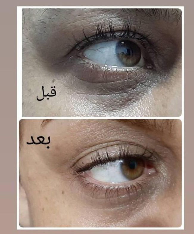 خرید کرم دور چشم ضد چروک و رفع سیاهی گاتیو اصل _ بیوممتیک