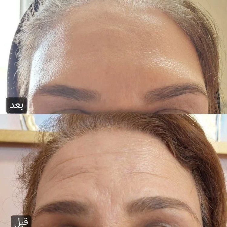 خرید کرم کلاژن و جوانسازی گاتیو اصل _ بیوممتیک