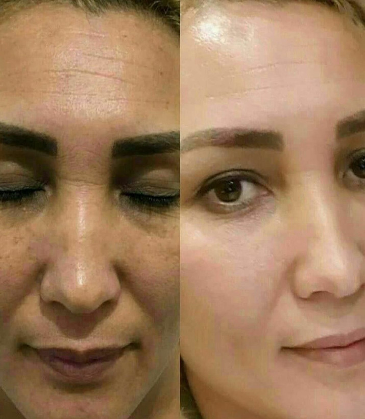 خرید کرم کلاژن و جوانسازی گاتیو اصل _ بیوممتیک