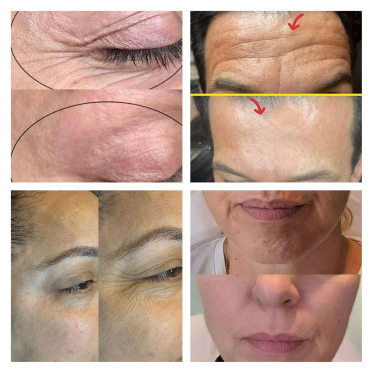 خرید کرم سفت کننده پوست لاکچری کوین اصل