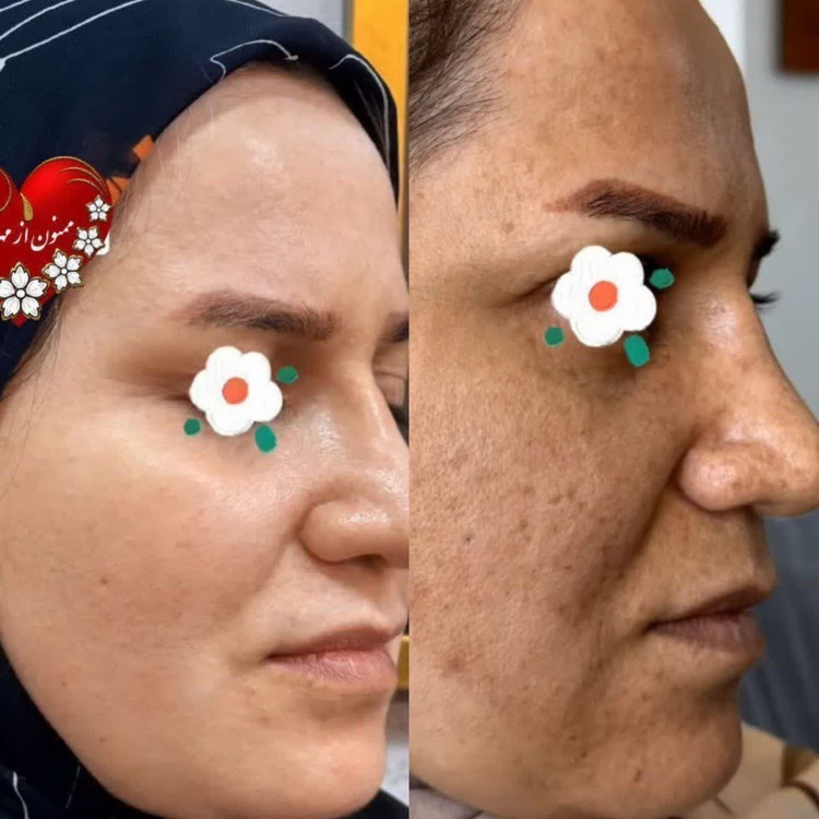 خرید کرم ضد لک لاکچری کوین اصل_۱۵ کاره معجزه