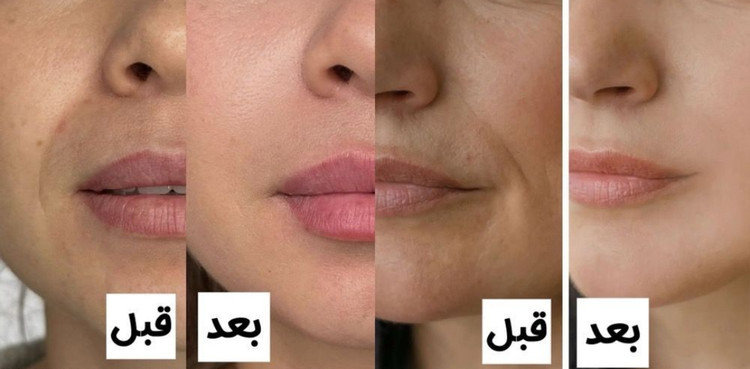 خرید کرم آبرسان لاکچری کوین اصل