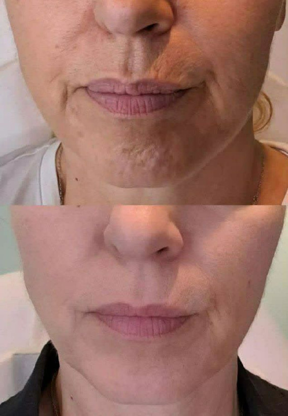 خرید ژل کرم آبرسان مخصوص پوست خشک ویتابلا اصل