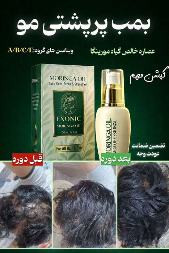 خرید روغن مورینگا اصل اکسونیک