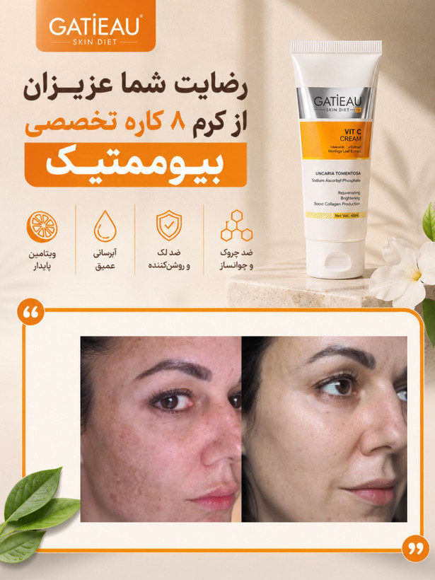 خرید کرم ویتامین سی گاتیو اصل -بیوممتیک